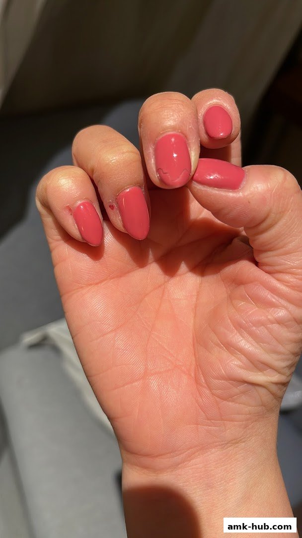 A close-up shot of a hand with chipped coral-pink nail polish.
