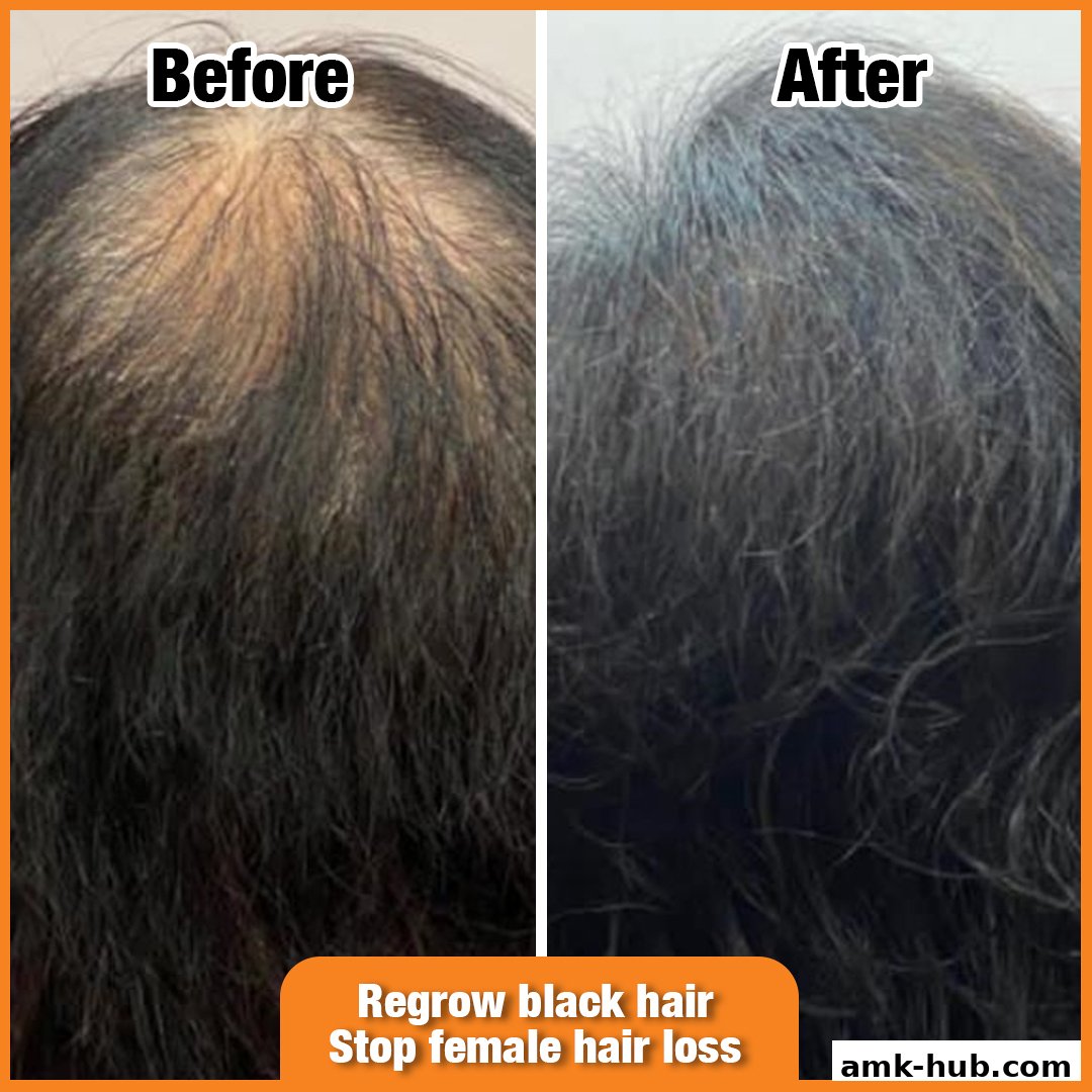 A split image showing a 'before' and 'after' of hair treatment, highlighting hair regrowth and color restoration.