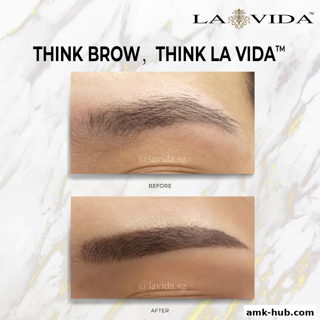 Before and after comparison of eyebrow enhancement at La Vida.