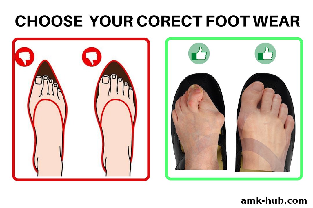 Image comparing correct and incorrect footwear for foot health.