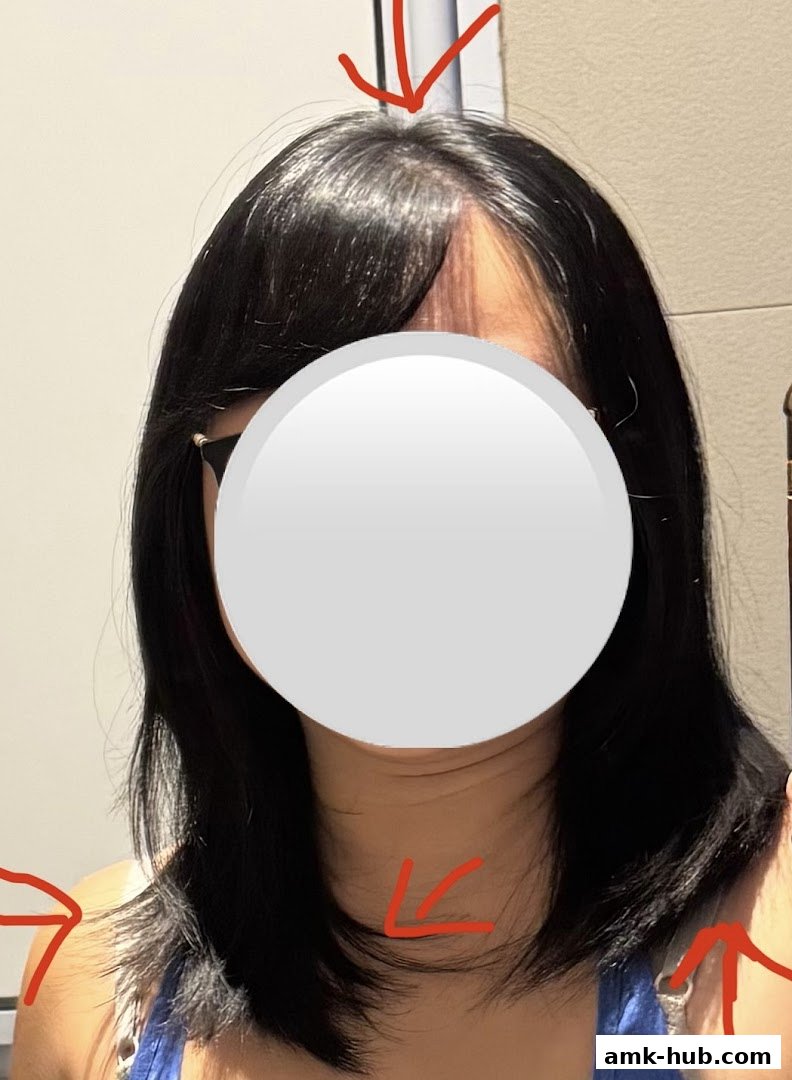 A person's head and shoulders with dark hair, showing a hairline and neck.