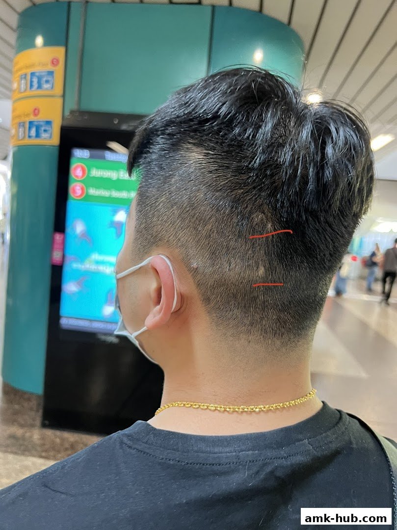 A person's head and neck with a fresh haircut, showing the back and side.