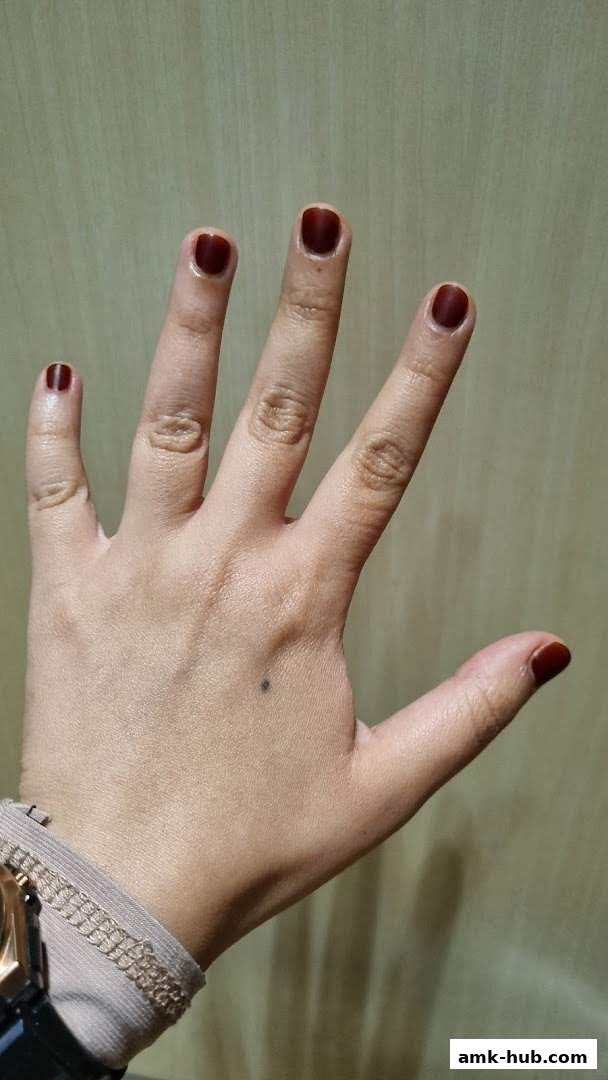 A hand with dark red nail polish and a mole on the palm.