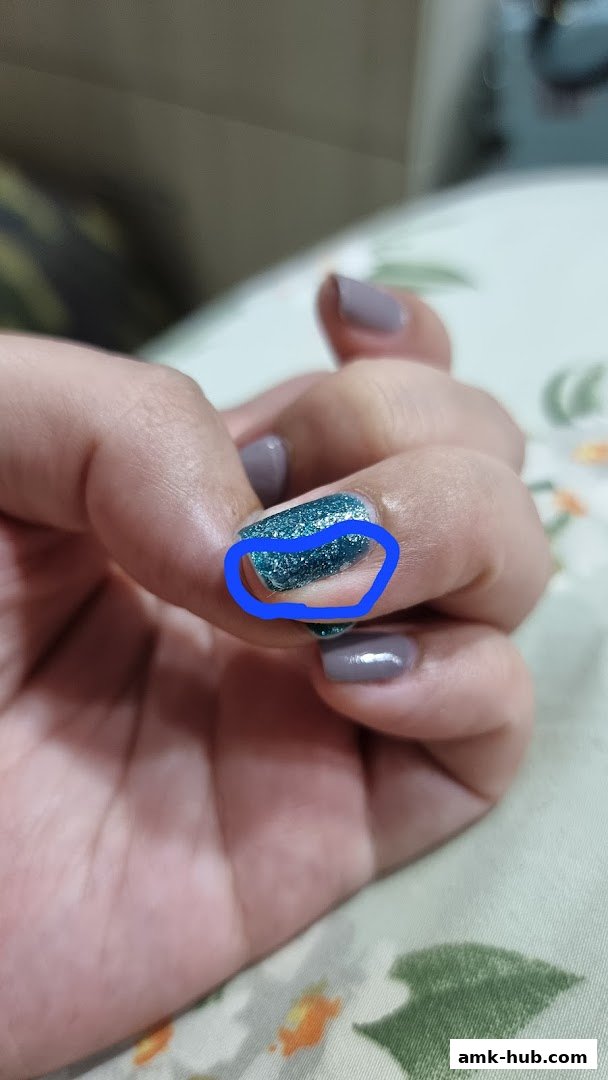 A close-up of a hand with a blue glitter nail polish on one finger.