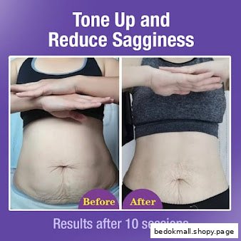 Before and after images showing abdomen slimming results.