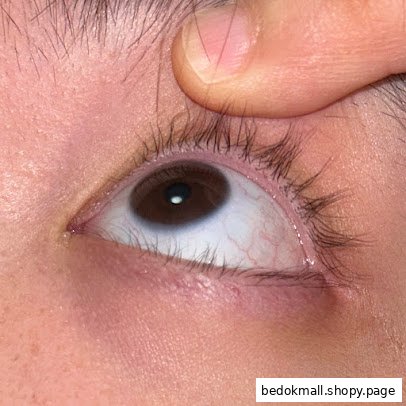 Close-up of a human eye with a finger pulling up the eyelid.
