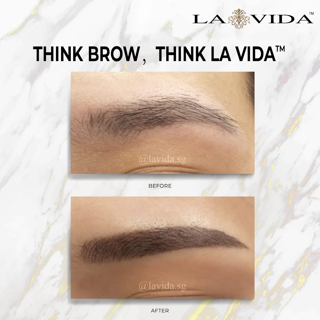 Before and after images of an eyebrow treatment.