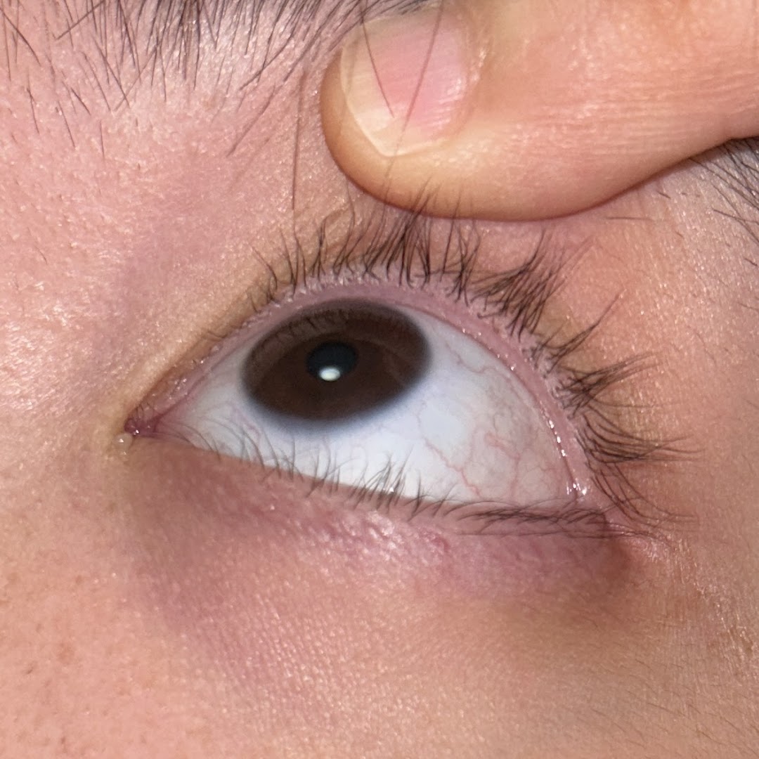 Close-up of a human eye with a finger holding the upper eyelid.