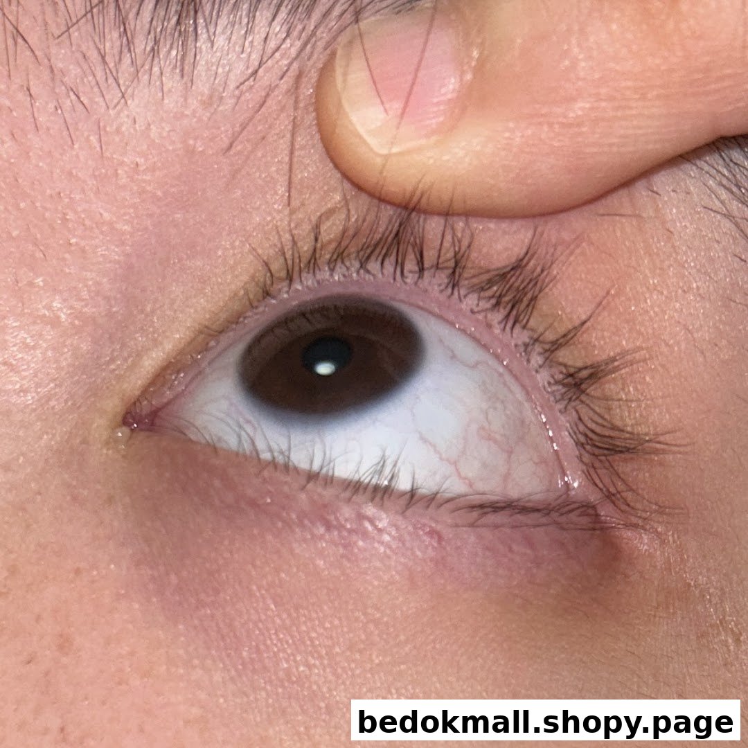 Close-up of a human eye with a finger holding the upper eyelid.