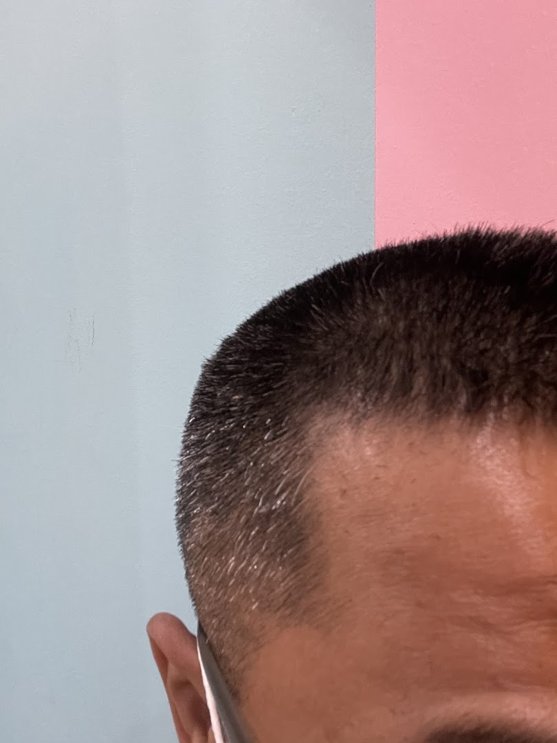 Close-up of a person's head with a short haircut against a two-tone wall.