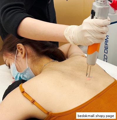 Laser treatment being performed on a person's back by a practitioner.