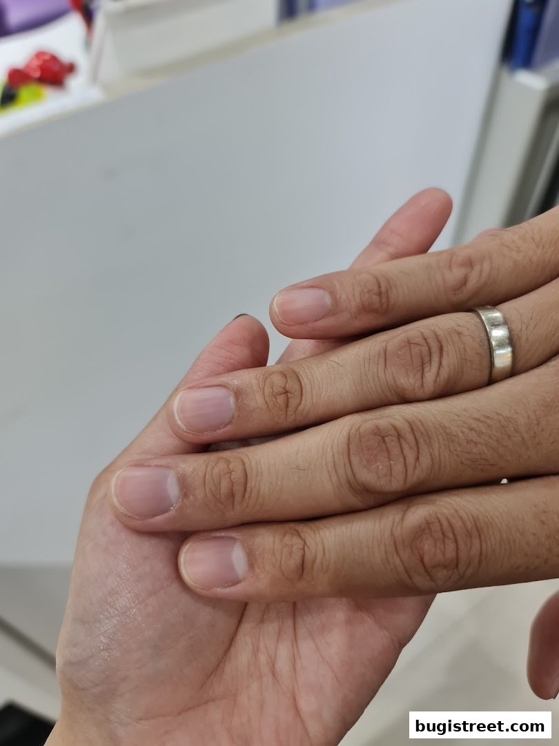 Close-up of two hands, one with a silver ring, showing natural nails.