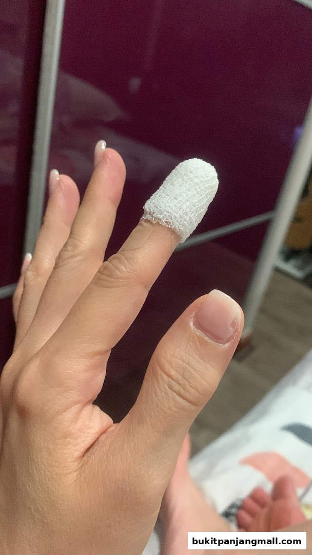 A close-up of a person's hand with a bandaged finger and manicured nails.