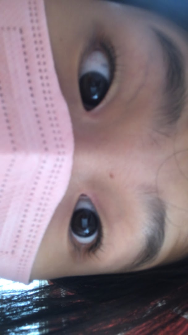 A close-up, rotated view of a person's eyes and forehead, partially obscured by a pink mask.
