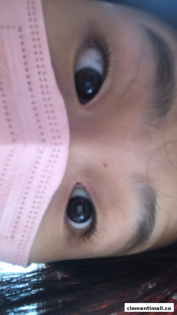 A close-up, rotated view of a person's eyes and forehead, partially obscured by a pink mask.