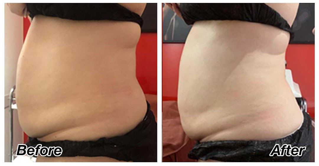 A 'before and after' comparison of a person's midsection showing weight loss results.