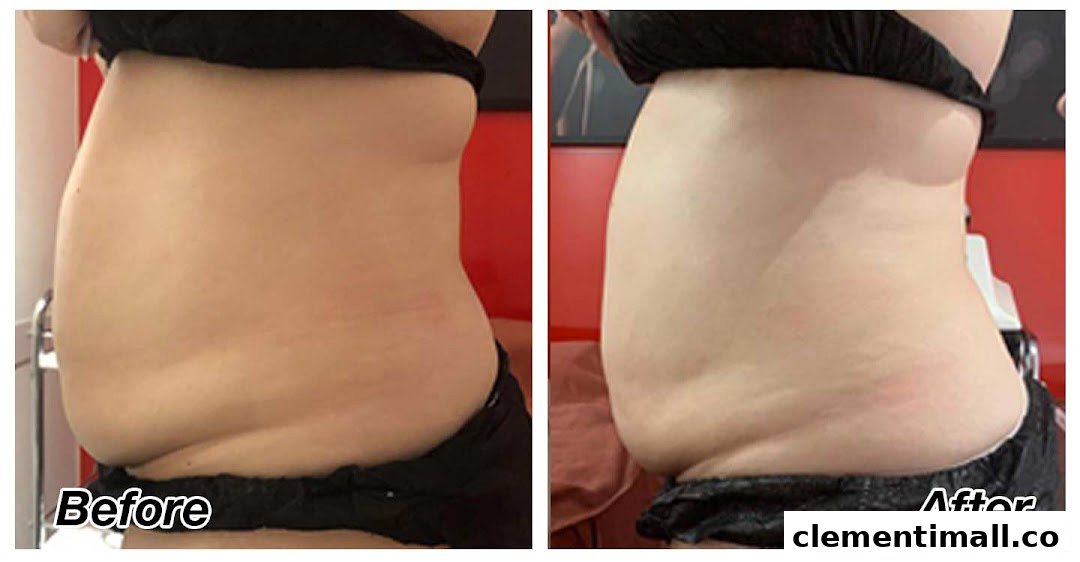 A 'before and after' comparison of a person's midsection showing weight loss results.