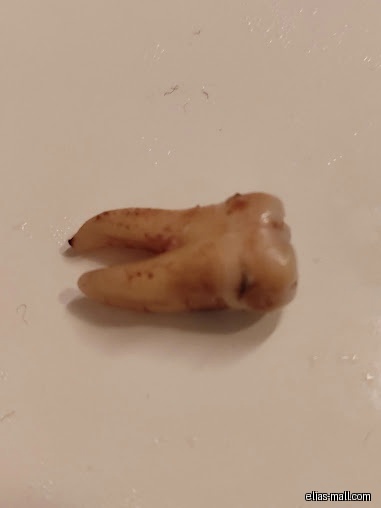 A single extracted tooth is displayed on a white surface.