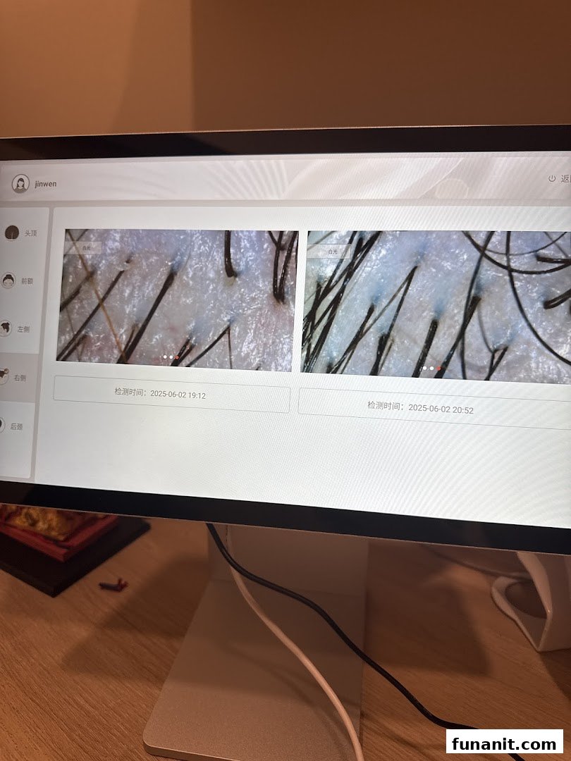 A computer screen displays magnified images of scalp and hair follicles during a hair consultation.