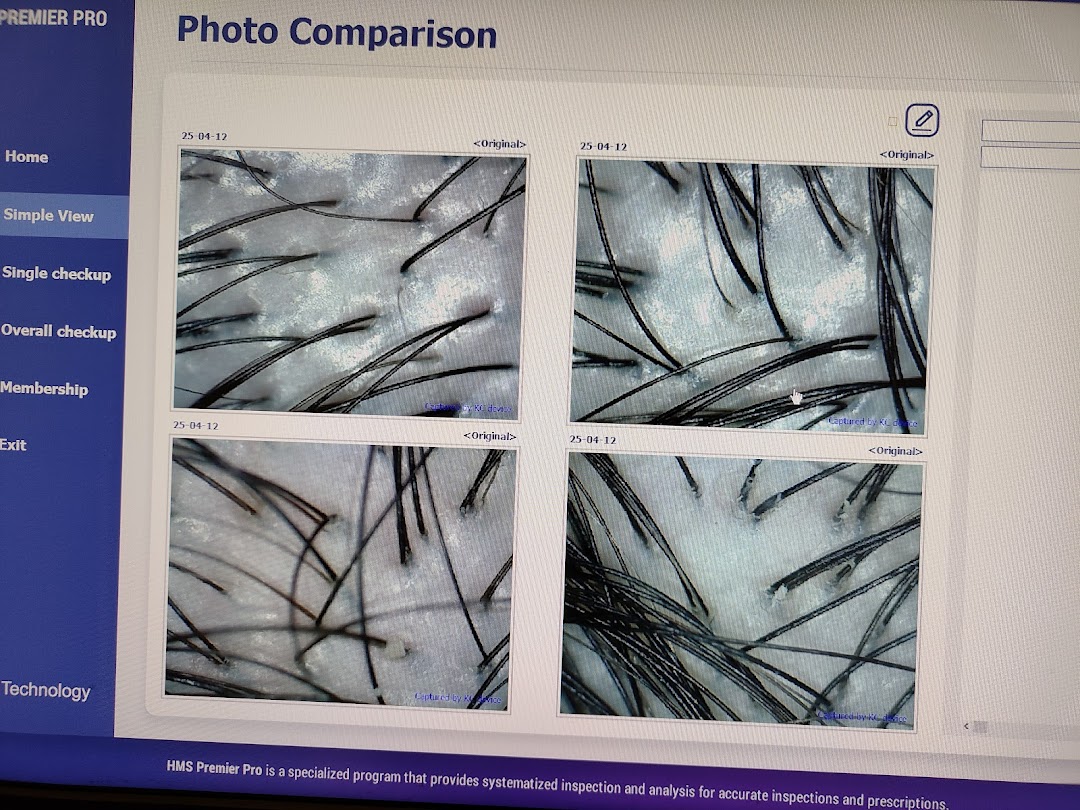 A computer screen displays microscopic images of hair and scalp for detailed analysis.