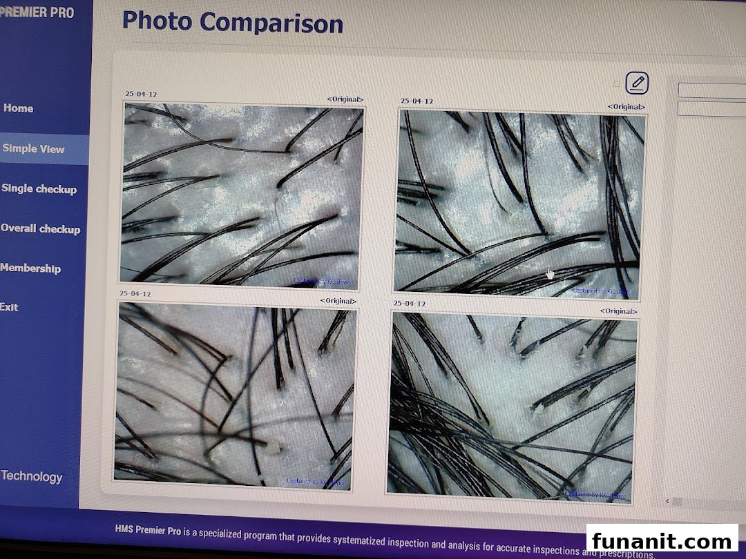 A computer screen displays microscopic images of hair and scalp for detailed analysis.