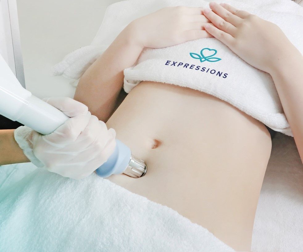 A person receiving a non-invasive slimming treatment on their abdomen at Expressions Funan.
