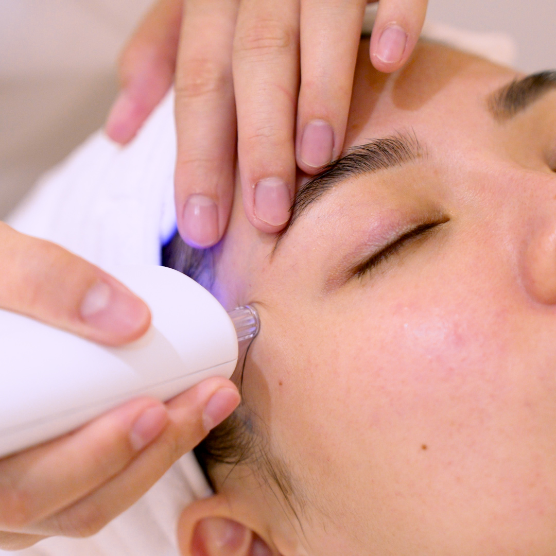Close-up of a person receiving a facial treatment with a specialized device at Skin Belief.