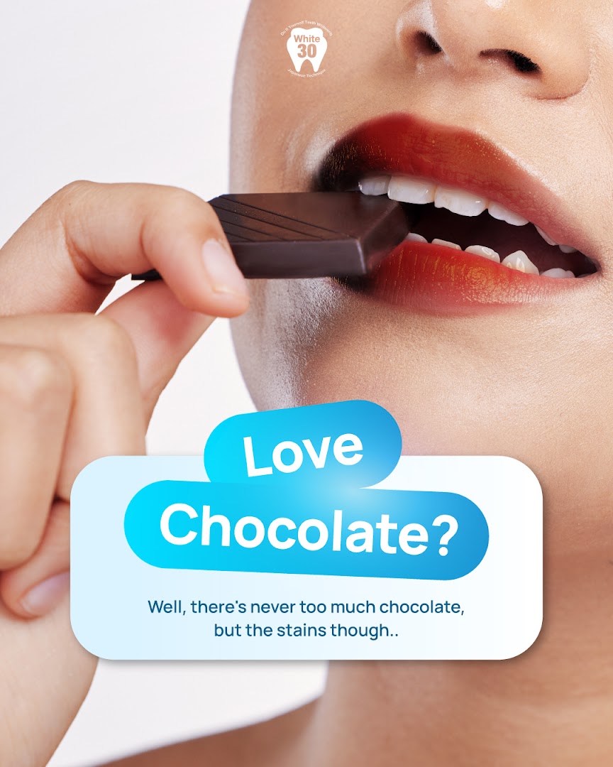 A person eating chocolate with text promoting teeth whitening by addressing chocolate stains.