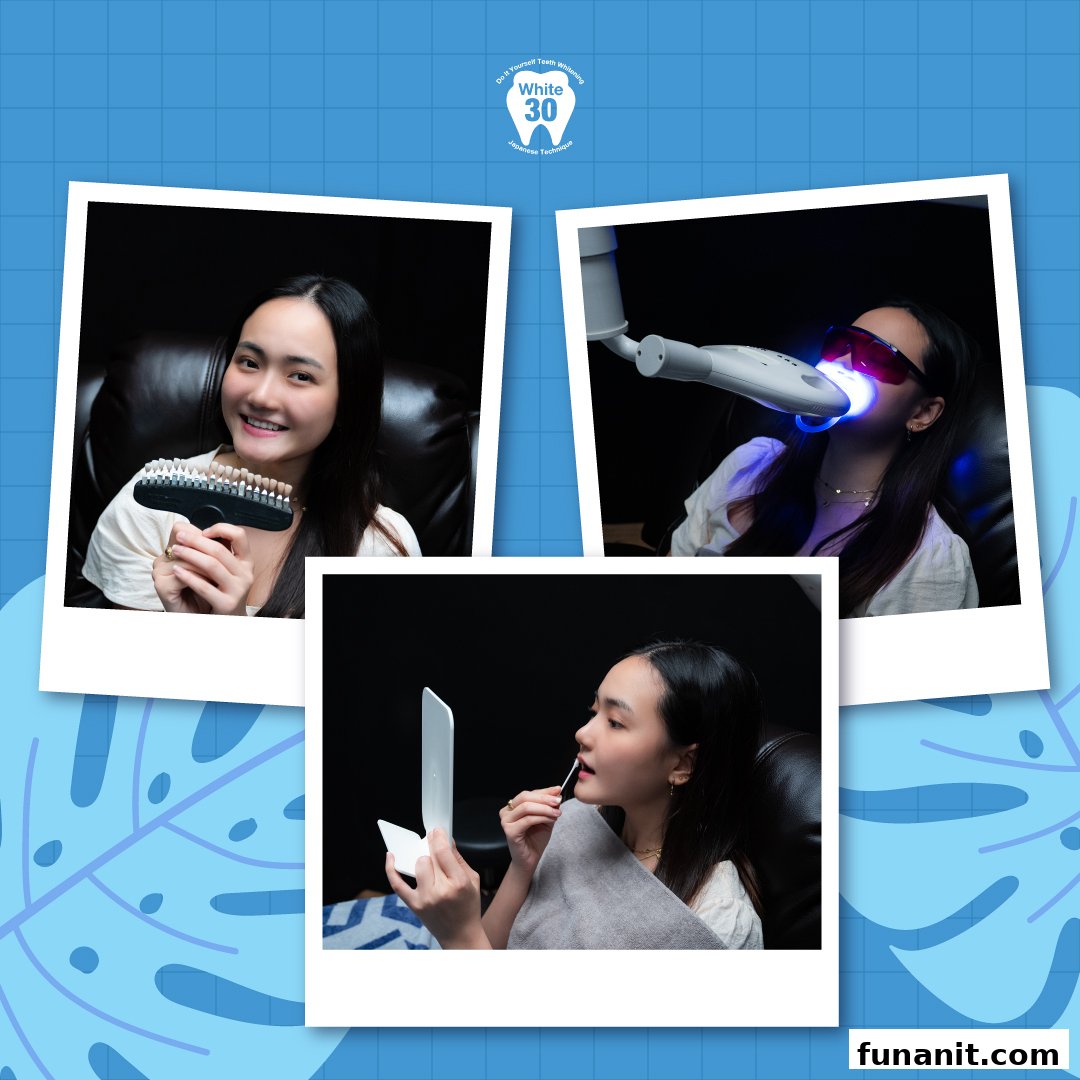 A collage showing a customer experiencing teeth whitening procedures at White30, highlighting the process and results.