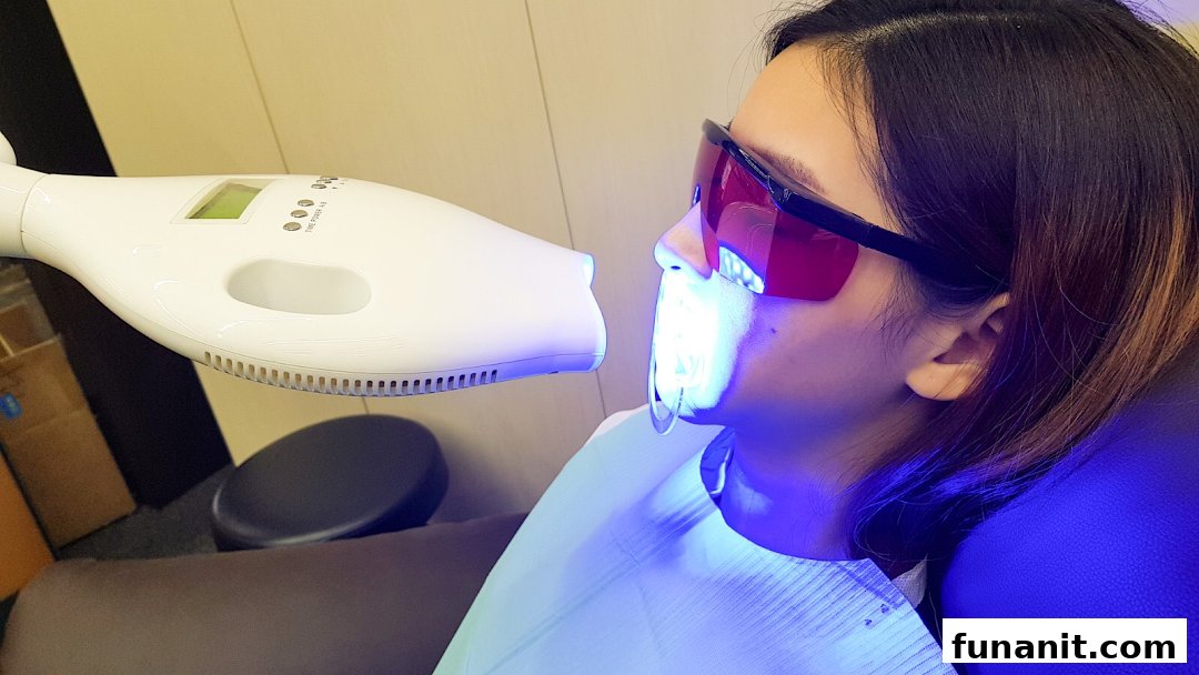 A person undergoing a teeth whitening treatment with a blue light device and protective eyewear.
