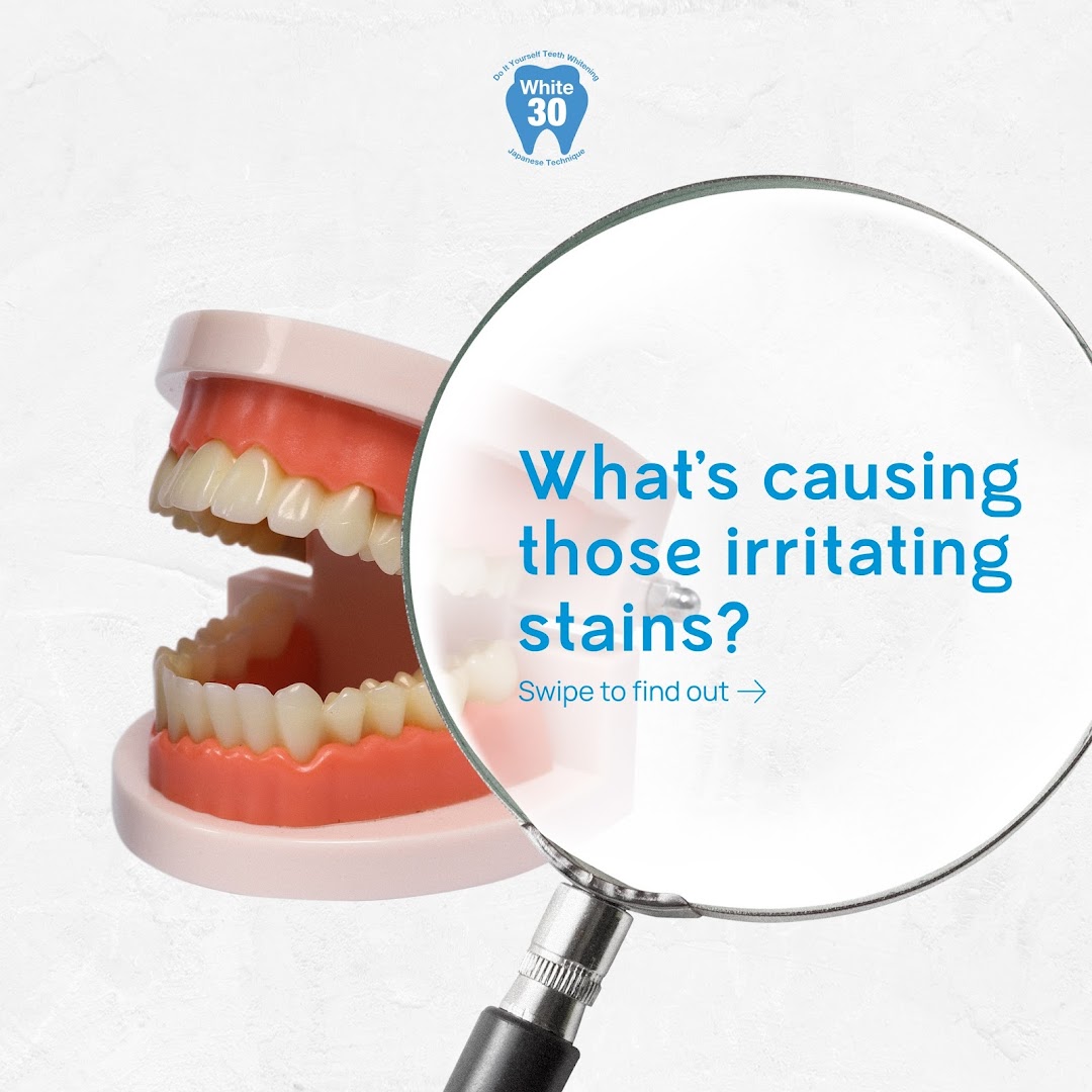 An image featuring a dental model and magnifying glass, with text about teeth stains and whitening.