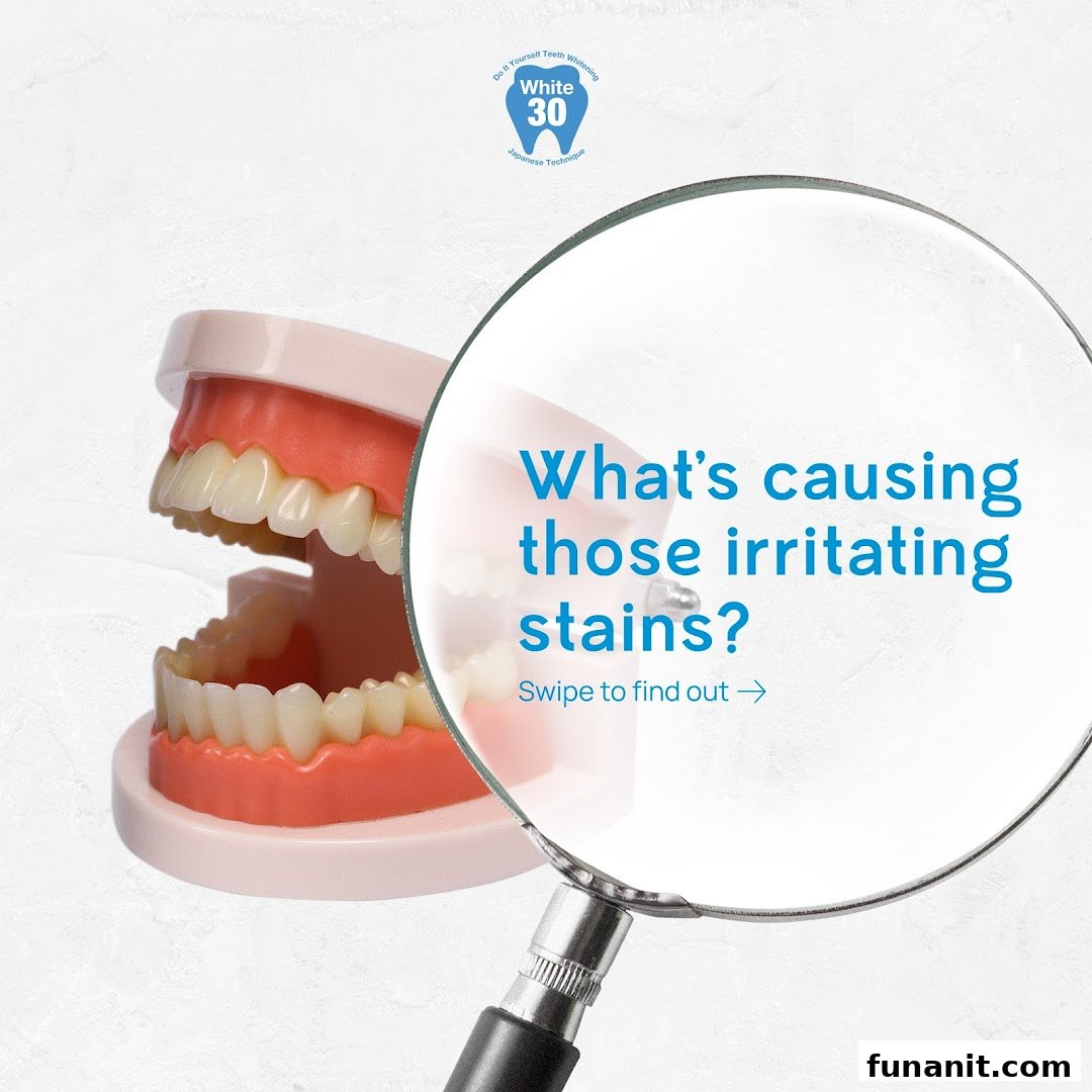 An image featuring a dental model and magnifying glass, with text about teeth stains and whitening.