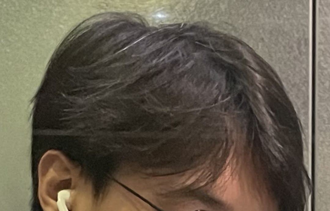 Close-up of a person's head, featuring dark hair and an earbud.