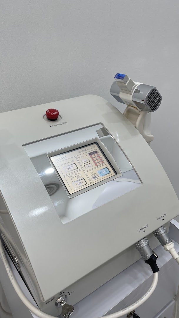 Close-up of an advanced IPL machine with a digital display and controls at Japan IPL Express.