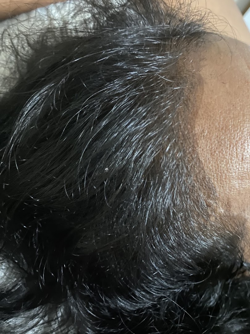Close-up of a person's scalp and dark hair, showcasing hair texture and density.