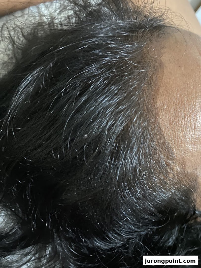 Close-up of a person's scalp and dark hair, showcasing hair texture and density.