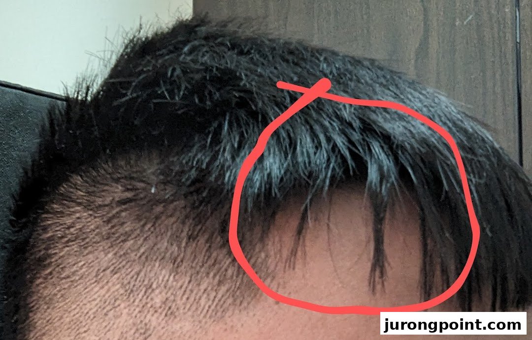 Close-up of a person's hair and scalp, highlighting a section with a red circle.