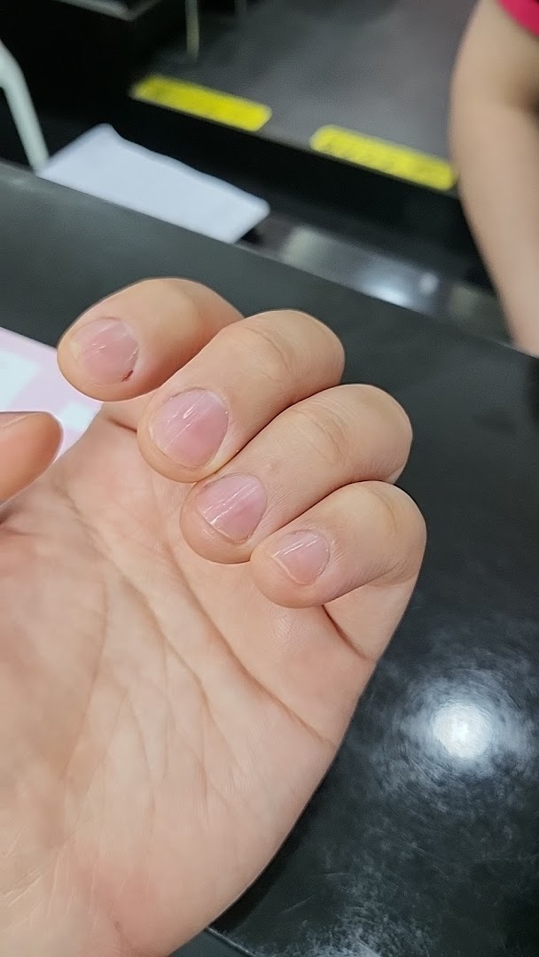 A close-up of a hand showcasing natural, unpolished fingernails, likely before or after a nail care service.