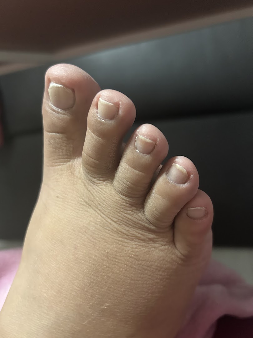 Close-up of a foot showing toenails, likely before or after a professional nail service.