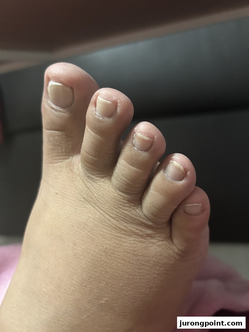 Close-up of a foot showing toenails, likely before or after a professional nail service.