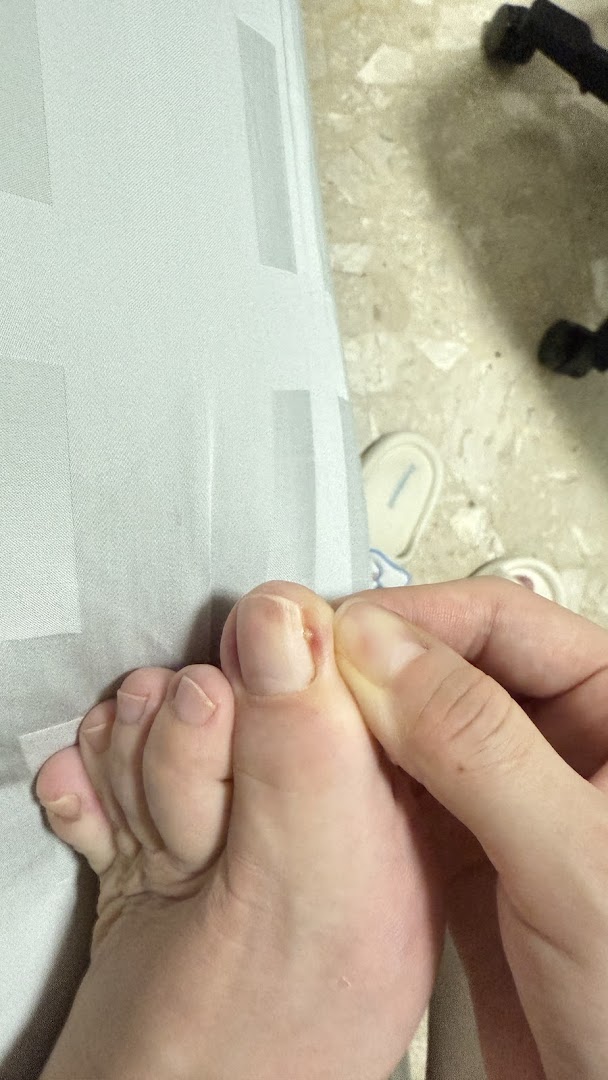 Close-up of a foot and toes, with a hand gently examining the big toe.