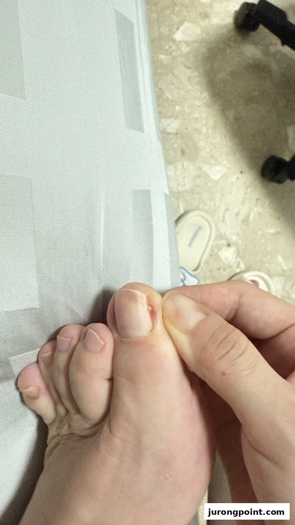 Close-up of a foot and toes, with a hand gently examining the big toe.