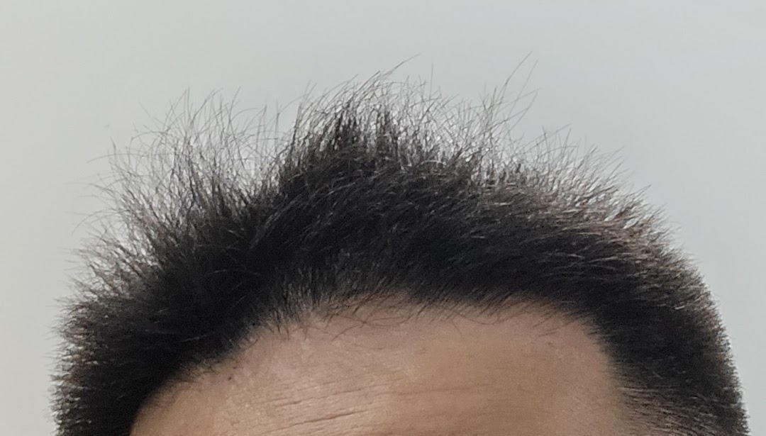 A close-up of a person's dark, textured hair and forehead, showcasing a fresh haircut.