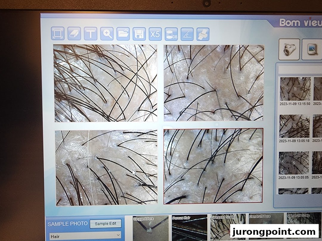 A computer screen displaying magnified images of a scalp and hair for detailed analysis.