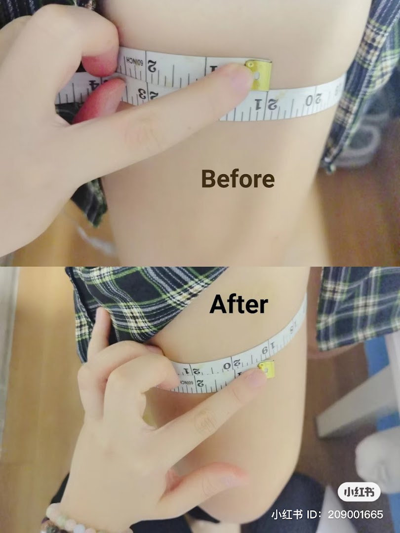 Before and after comparison of a body part measured with a tape, showcasing treatment results.