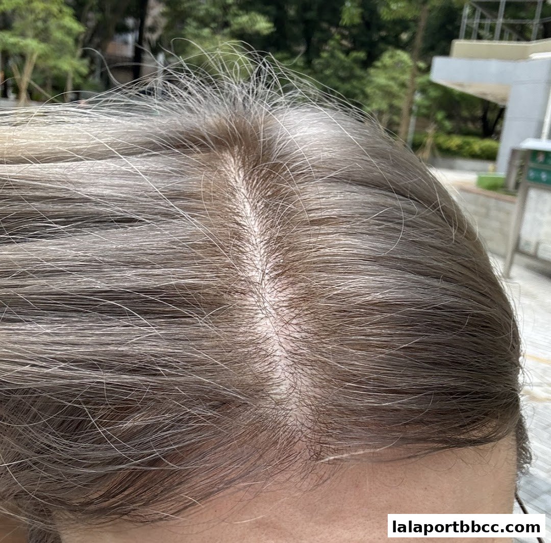 Close-up view of a person's scalp and hair, showing the parting.