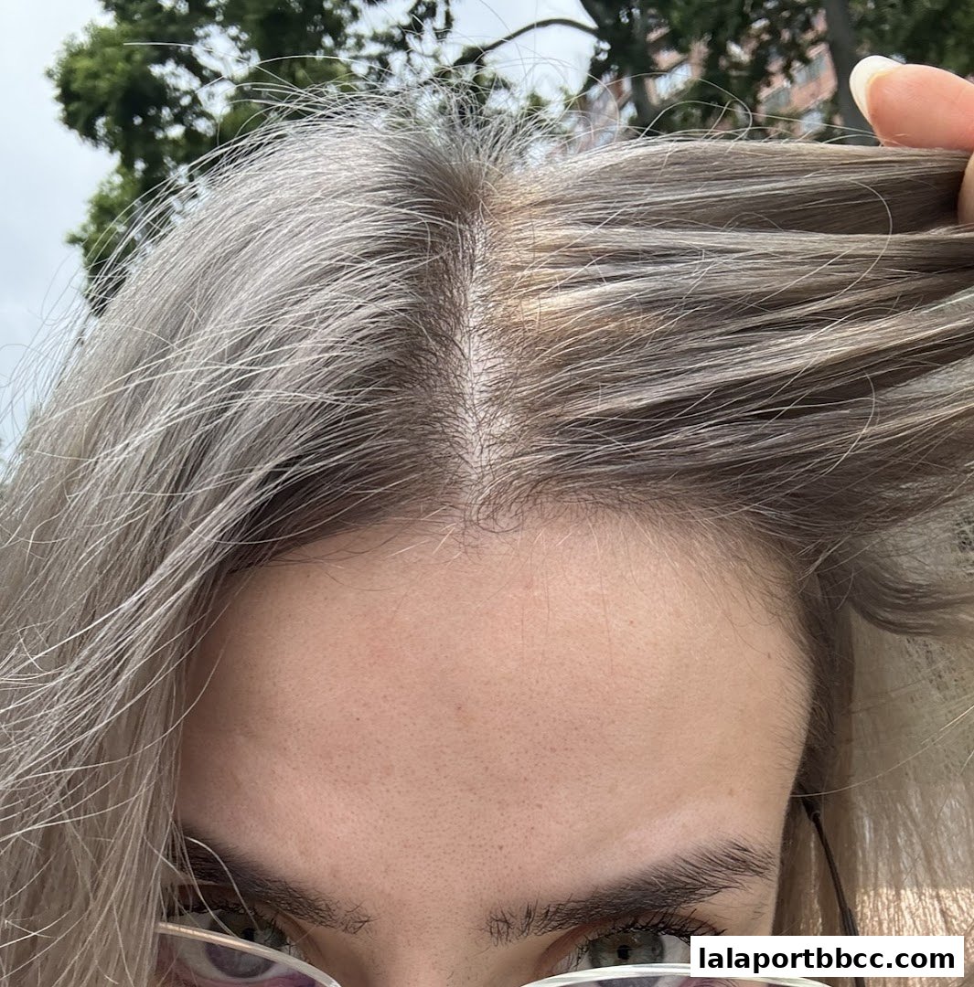 Close-up of a person's scalp and forehead with blonde hair.