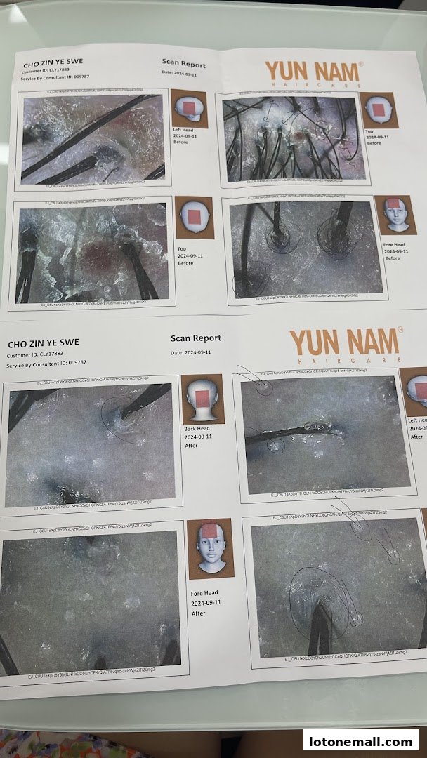 A hair scan report showing before and after images of a customer's scalp.