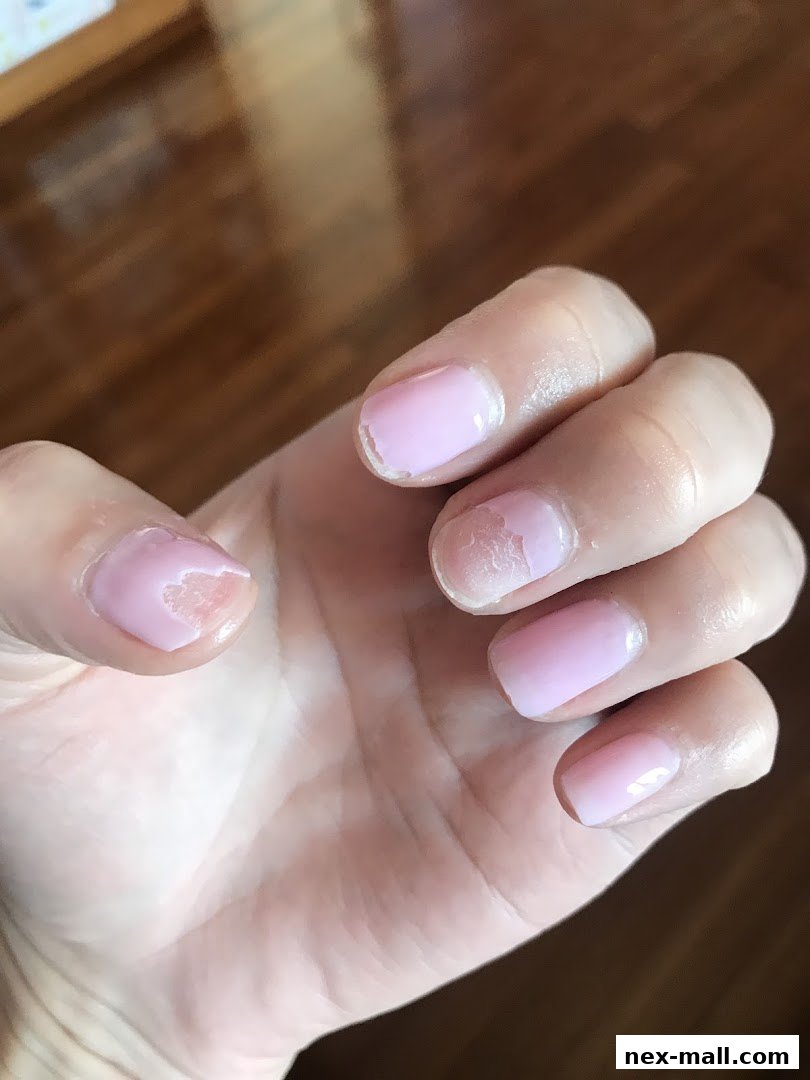 A close-up of a hand with chipped pink gel nail polish.