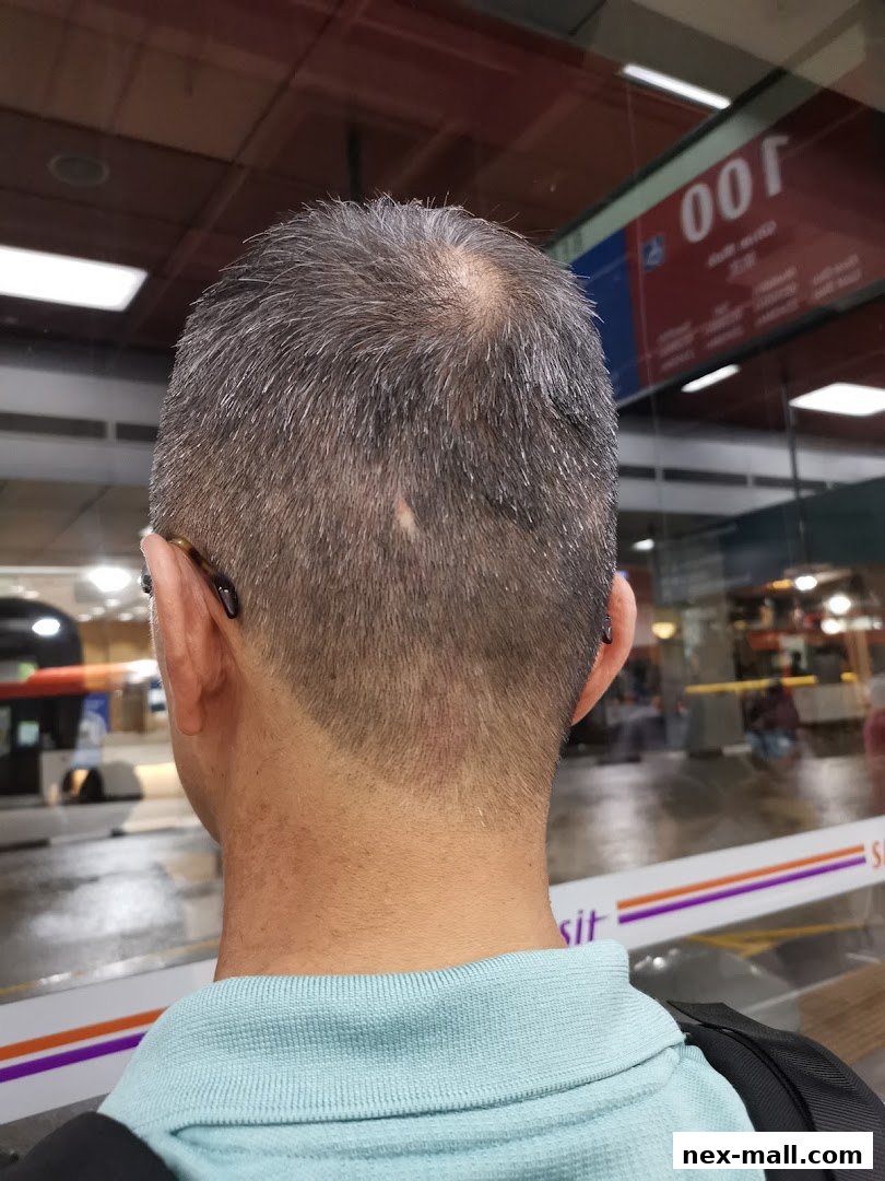 A person's head and neck are shown from behind, with a reflection of a shop in the background.